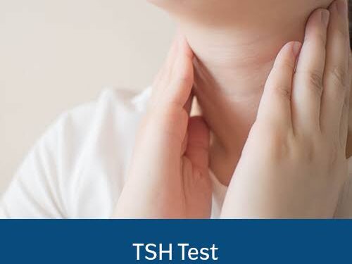 Thyroid Test at Home: A Comprehensive Guide to Monitoring Your Thyroid Health